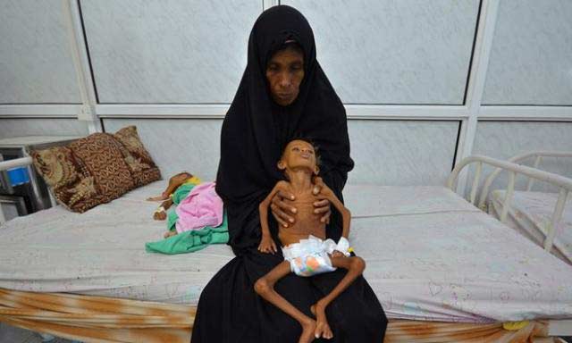 أطفال المسلمين يموتون جوعا بسبب الحكام المجرمين